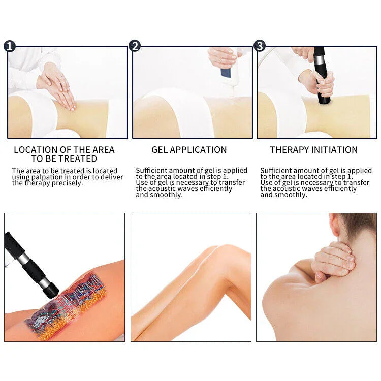 Shockwave Therapy Side Effects: What Is Normal After Treatment? - Huanshibeauty