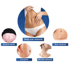 RF Fractional Microneedle 7d Vaginal VMAX Hifu Machine Skin Tightening Face Lifting