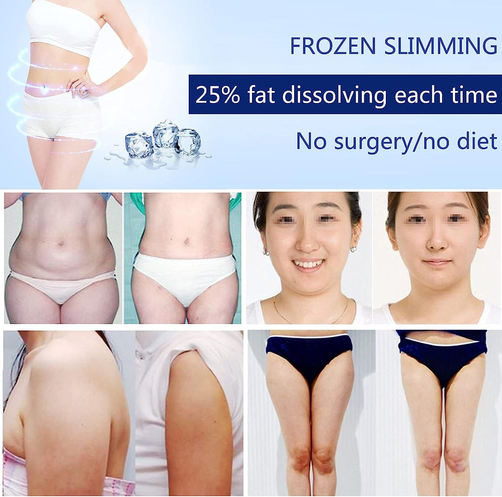 Fat Freezing Cryolipolysis Machine Anti-Cellulite Body Slimming Sculpting Device