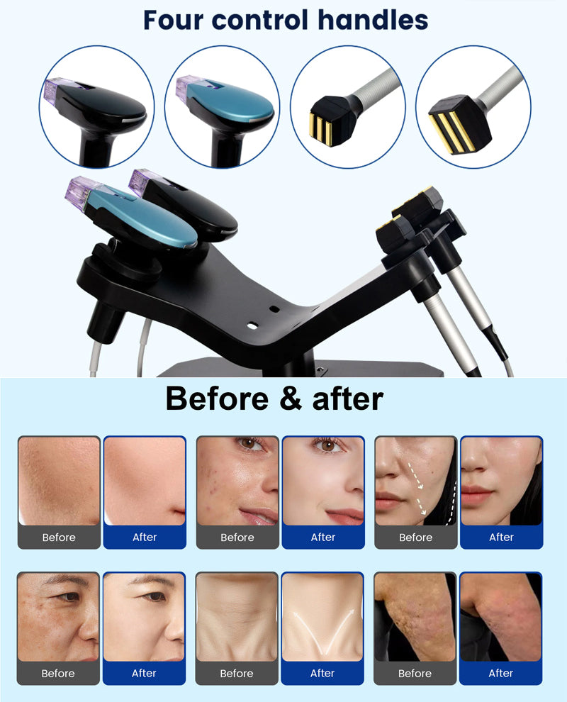 Facial EMRF Morpheus M8 RF Microneedle Skin Tightening Anti-aging Beauty Device