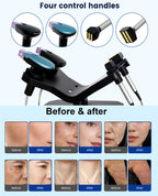 Facial EMRF Morpheus M8 RF Microneedle Skin Tightening Anti-aging Beauty Device