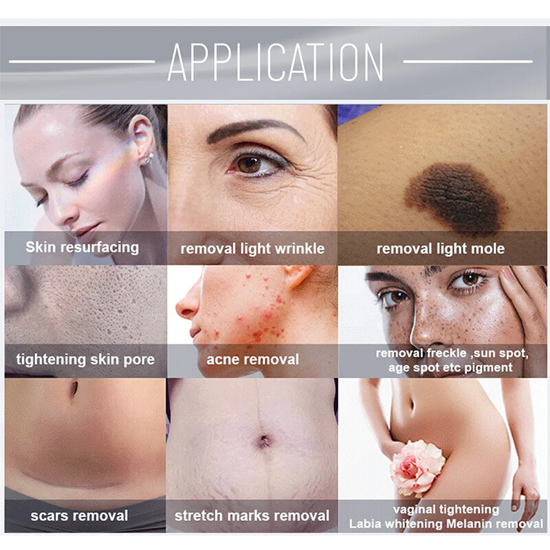 CO2 Fractional Skin Tightening Laser Acnes Scar Removal Skin Resurfacing Machine