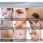 CO2 Fractional Skin Tightening Laser Acnes Scar Removal Skin Resurfacing Machine