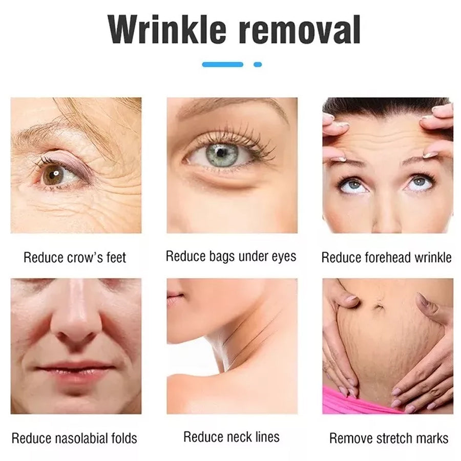 Ultrasound 7D HIFU Machine Facial Tightening Skin Lifting Body Slimming Wrinkle Removal