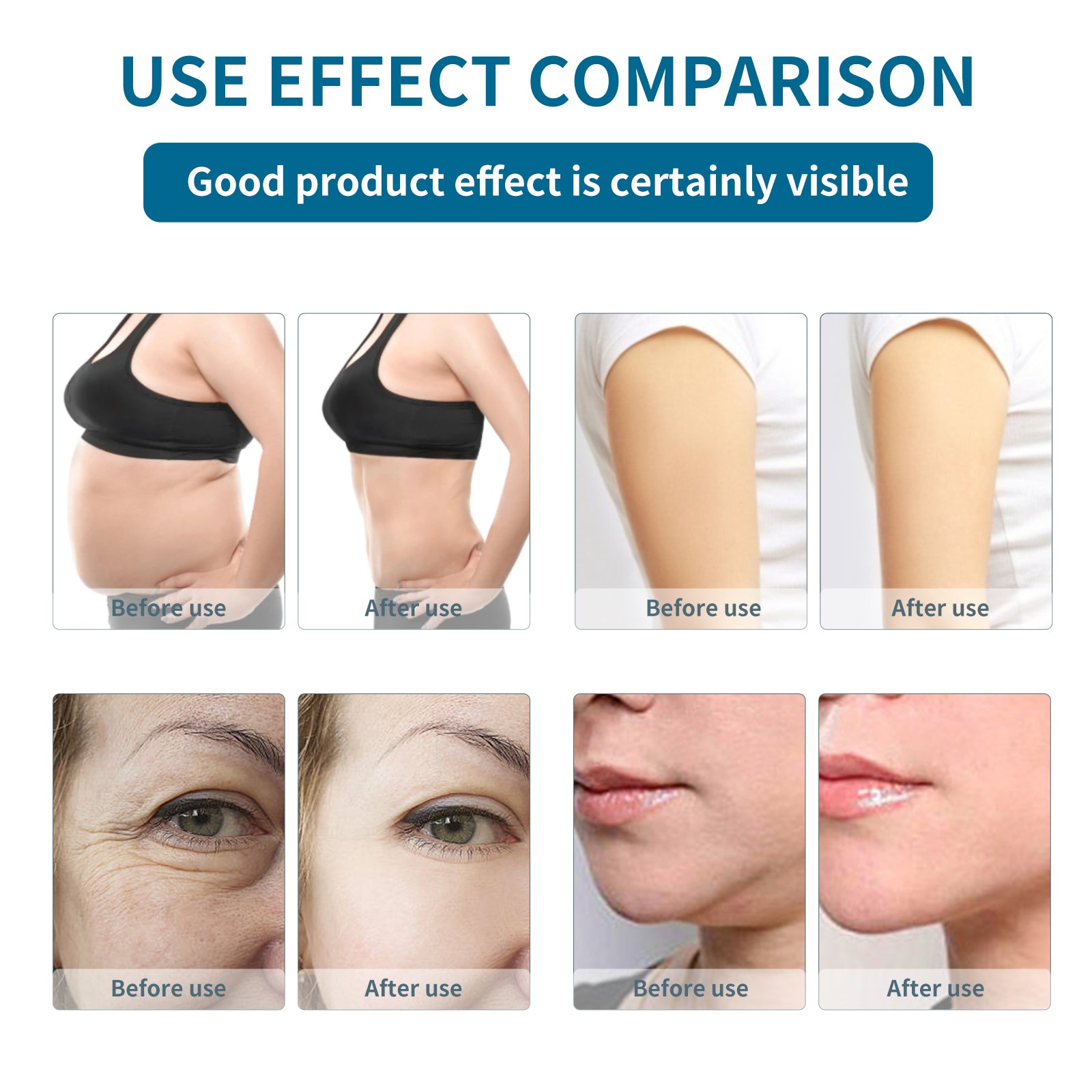 6-in-1 Body Slimming Cavitation Body Shaping 40K RF Laser Lipolysis Machine