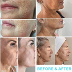7D HIFU Facial Lifting Tightening Body Sculpting Machine Ultrasound Cellulite Removal