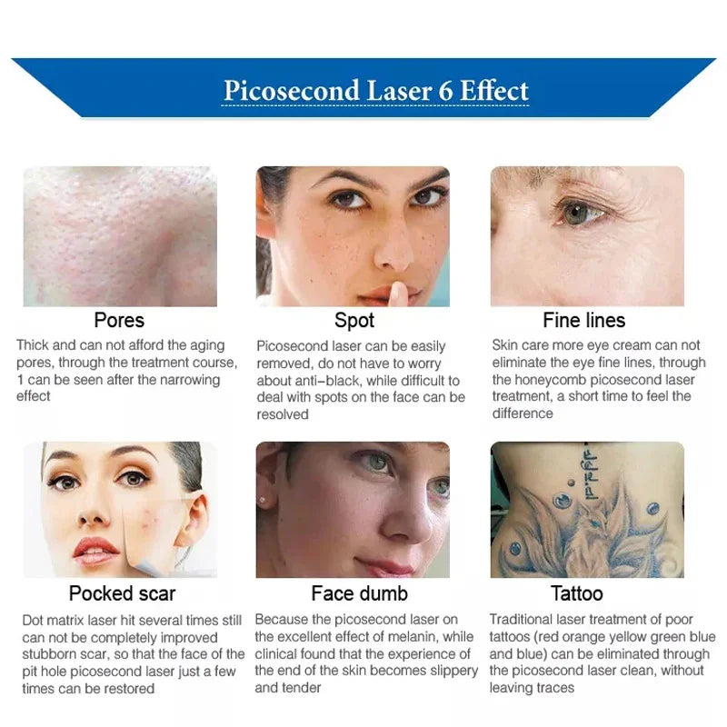 CO2 Fractional Laser Skin Vaginal Tightening Machine Rejuvenation Stretch Marks Removal