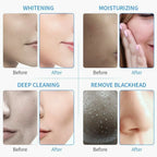 6 In 1 Hydra Machine Facial Water Dermabrasion Deep Cleansing Face Hydro Spa Skin