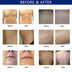 808nm Diode Laser Hair Removal Picosecond Tattoo Removal Skin Care Machine Women