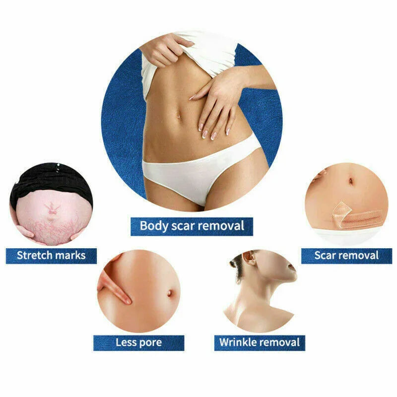 Newest M8 RF Microneedle Machine Skin Tightening Wrinkle Removal Face Lift Body Stretch Mark Removal
