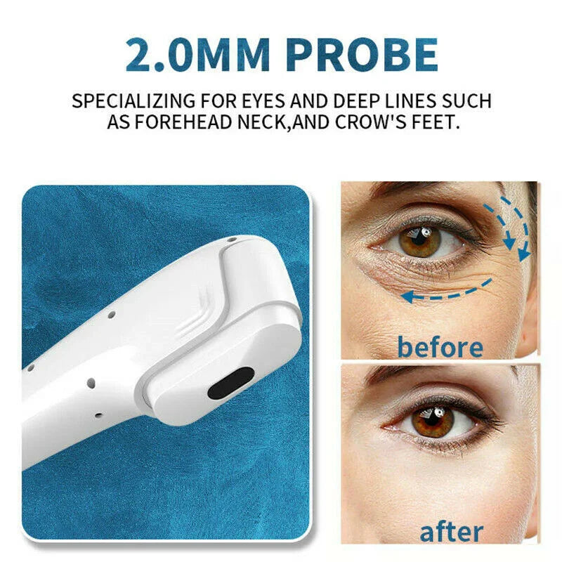 2 In 1 Hifu 7D RF Fractional Microneedle Skin Tightening Anti Wrinkle Stretch Marks Removal Machine