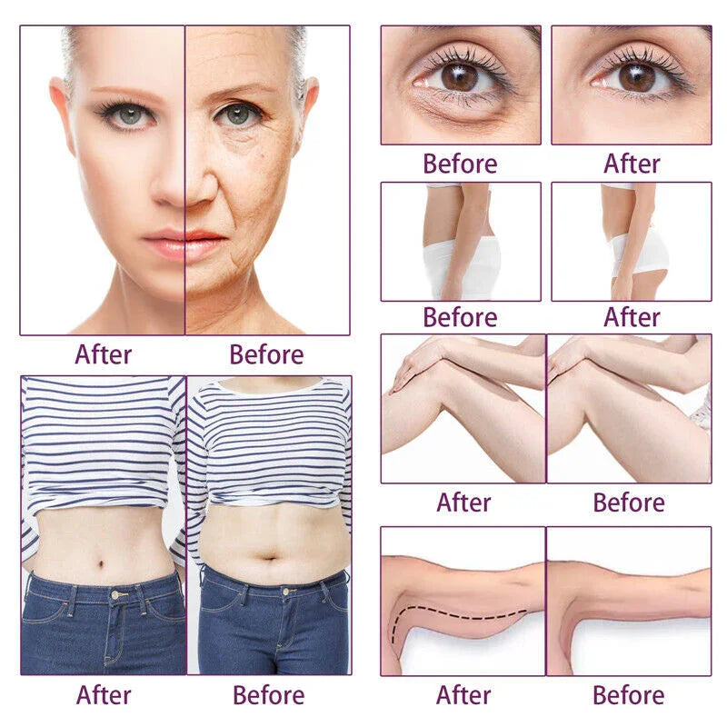 6 In 1 40K Cavitation Lipo Laser Facial RF Loss Weight Body Slimming Skin Lifting Machine