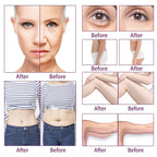 6 In 1 40K Cavitation Lipo Laser Facial RF Loss Weight Body Slimming Skin Lifting Machine