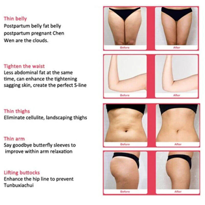 14 Pad Lipo Laser Body Contouring Machine for Beauty Clinics & Spas