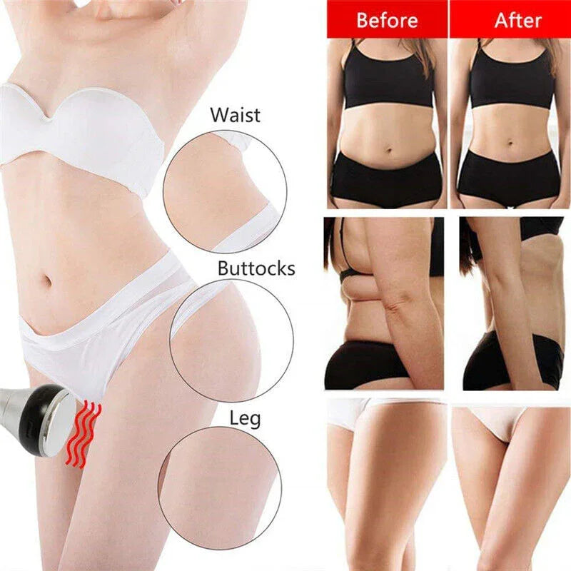6 In 1 40K Cavitation Lipo Laser Facial RF Loss Weight Body Slimming Skin Lifting Machine