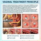 Professional Fractional CO2 Laser Machine 10600nm Skin Resurfacing Mole Removal Tightening Vaginal Stretch Mark Acne Scar Treatment Equipment
