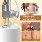 CO2 Fractional Laser Machine Skin Rejuvenation Acne Treatment Stretch Marks Scar Removal Device