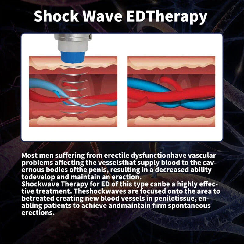 Shockwave Therapy Machine for Physical Therapy and Body Relaxation