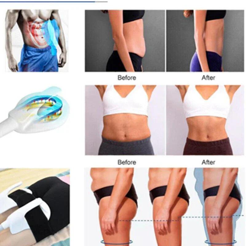 Body Sculpting Slimming Muscle Shape Building Stimulate Machine Abs Fat Loss