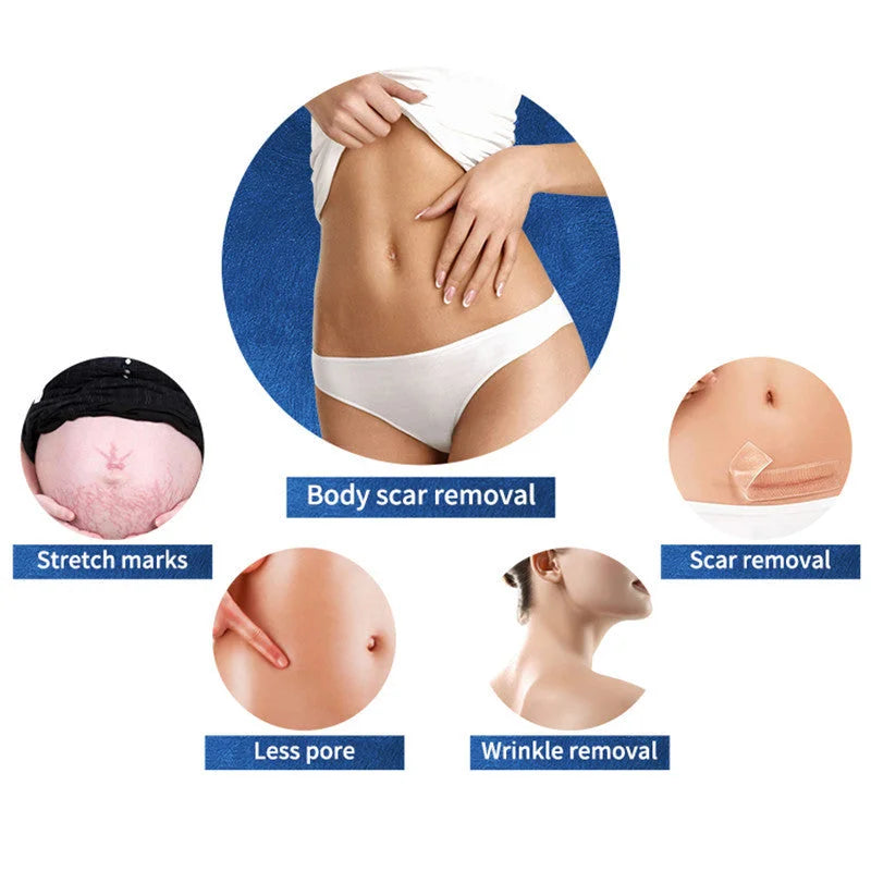 7d Hifu + Vaginal + VMAX + RF Fractional Microneedle Machine  Skin Tightening Face Lifting