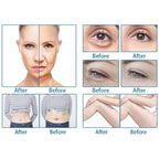 2 In 1 Ultra Hifu Facial Lifting Winkle Removal Machine Vmax RF Anti Aging Body Shaping