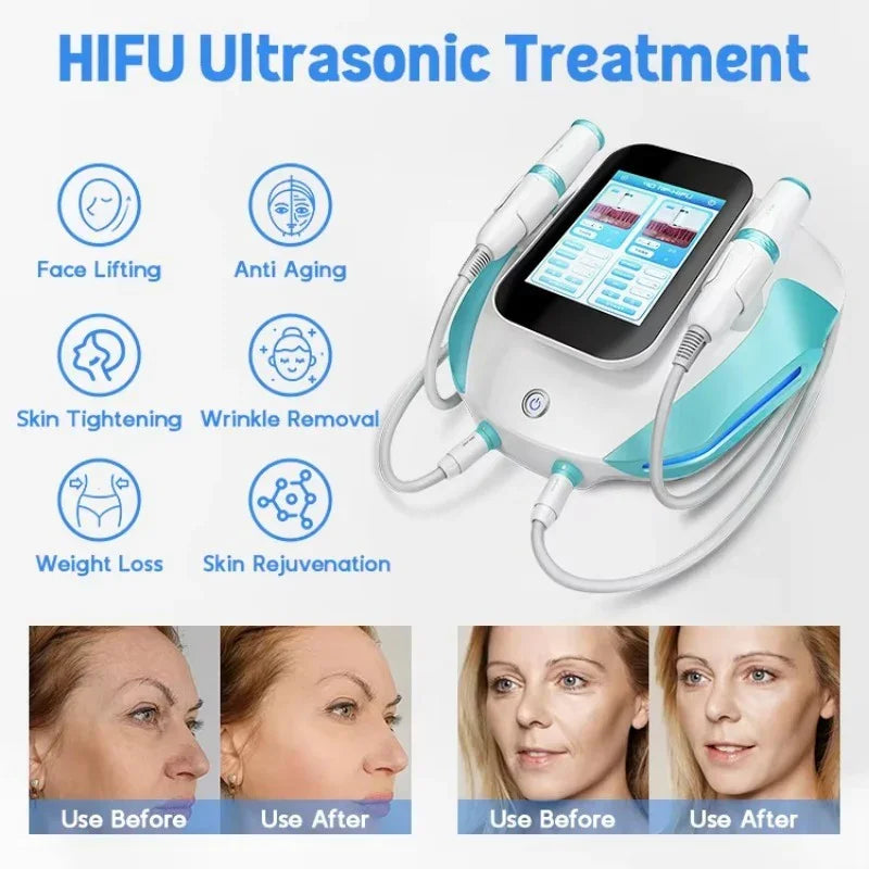 2 In 1 Ultra Hifu Facial Lifting Winkle Removal Machine Vmax RF Anti Aging Body Shaping