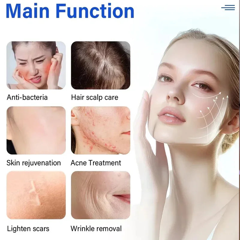 Cold Plasma Fusion Machine Collagen Stimulation Anti Wrinkle Spot Lightening