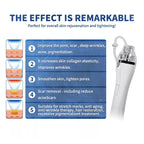 Microneedle RF Fractional Skin Lifting Stretch Marks Wrinkle Removal Machine With Cold Hammer