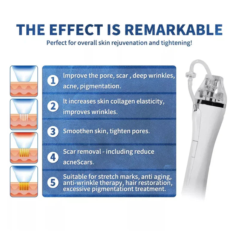 Microneedle RF Fractional Skin Lifting Stretch Marks Wrinkle Removal Machine With Cold Hammer