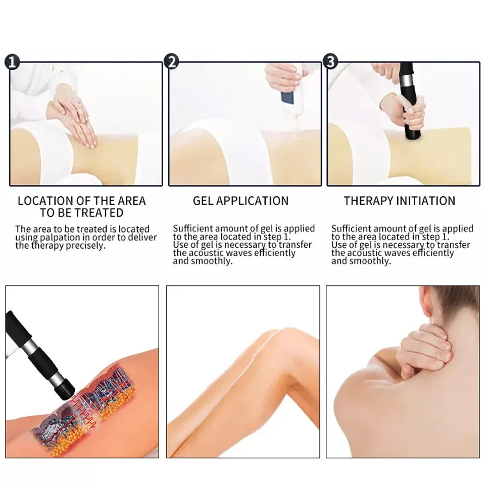 Radial Pneumatic Shockwave Therapy Machine for Pain Relief and Muscle Recovery