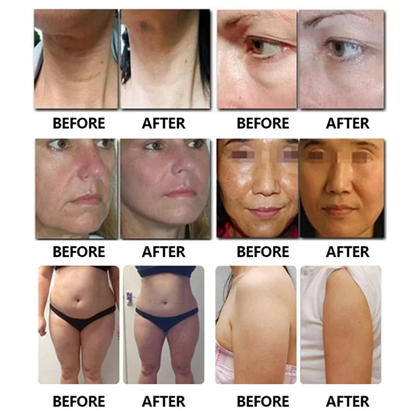 Ultrasound 7D HIFU Machine Facial Tightening Skin Lifting Body Slimming Wrinkle Removal
