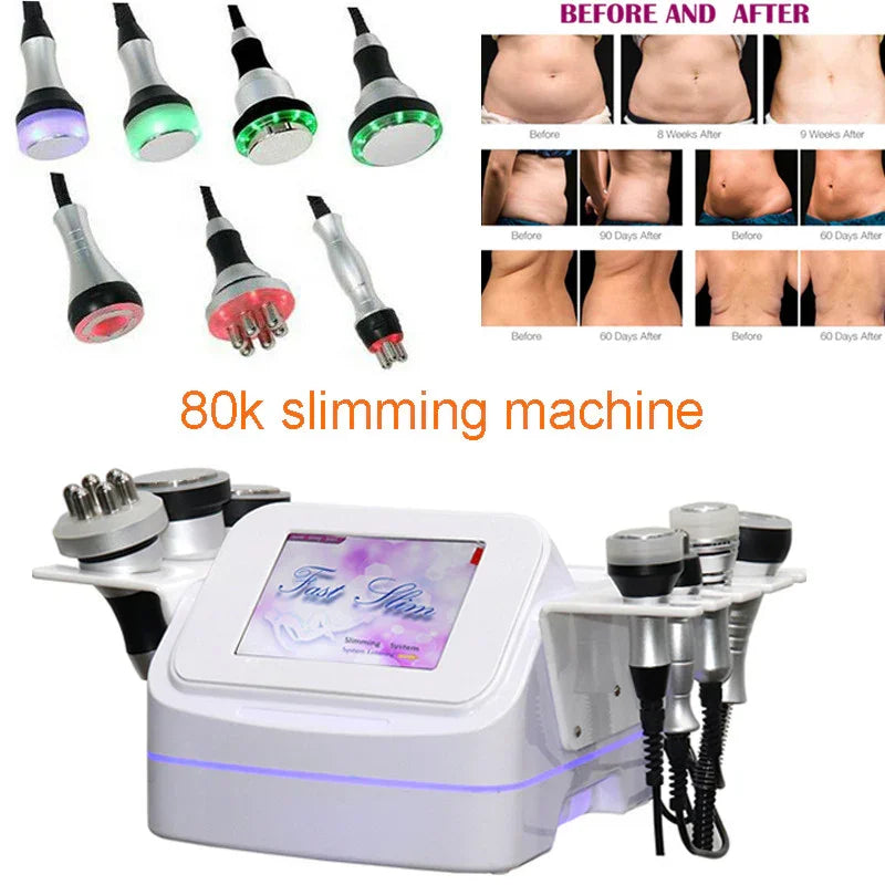 80K Radio Frequency RF Body Slimming Machine Vacuum Fat Reduce SPA Weight Loss Main image