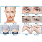 RF Fractional Microneedle 7d Hifu Machine Skin Tightening Body Face Lifting Care