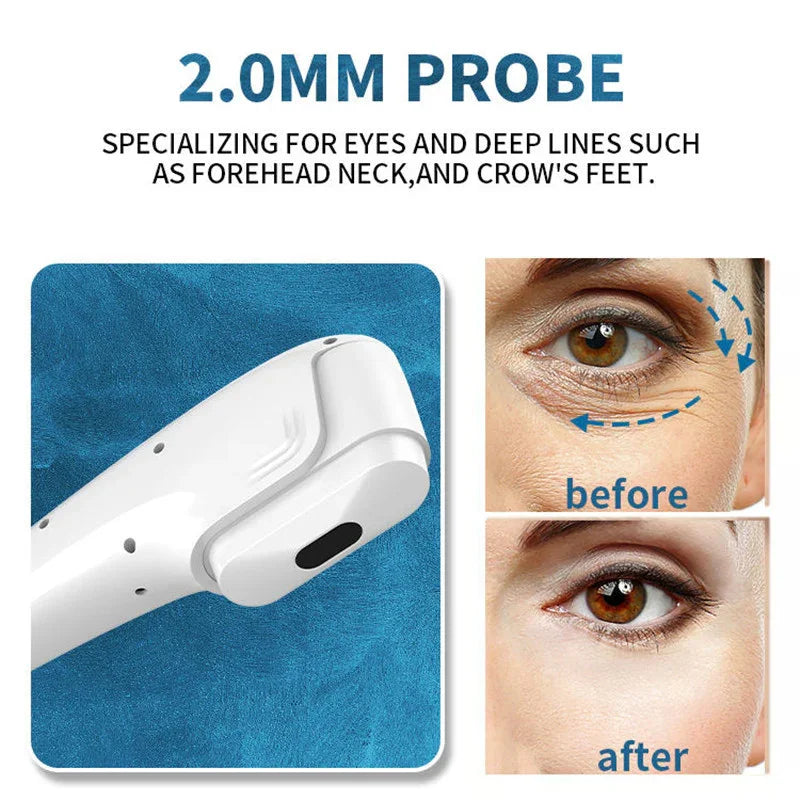 7d Hifu + Vaginal + VMAX + RF Fractional Microneedle Machine  Skin Tightening Face Lifting