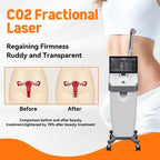 CO2 Fractional Laser Machine Skin Resurfacing Rejuvenation Scar Acne Repair