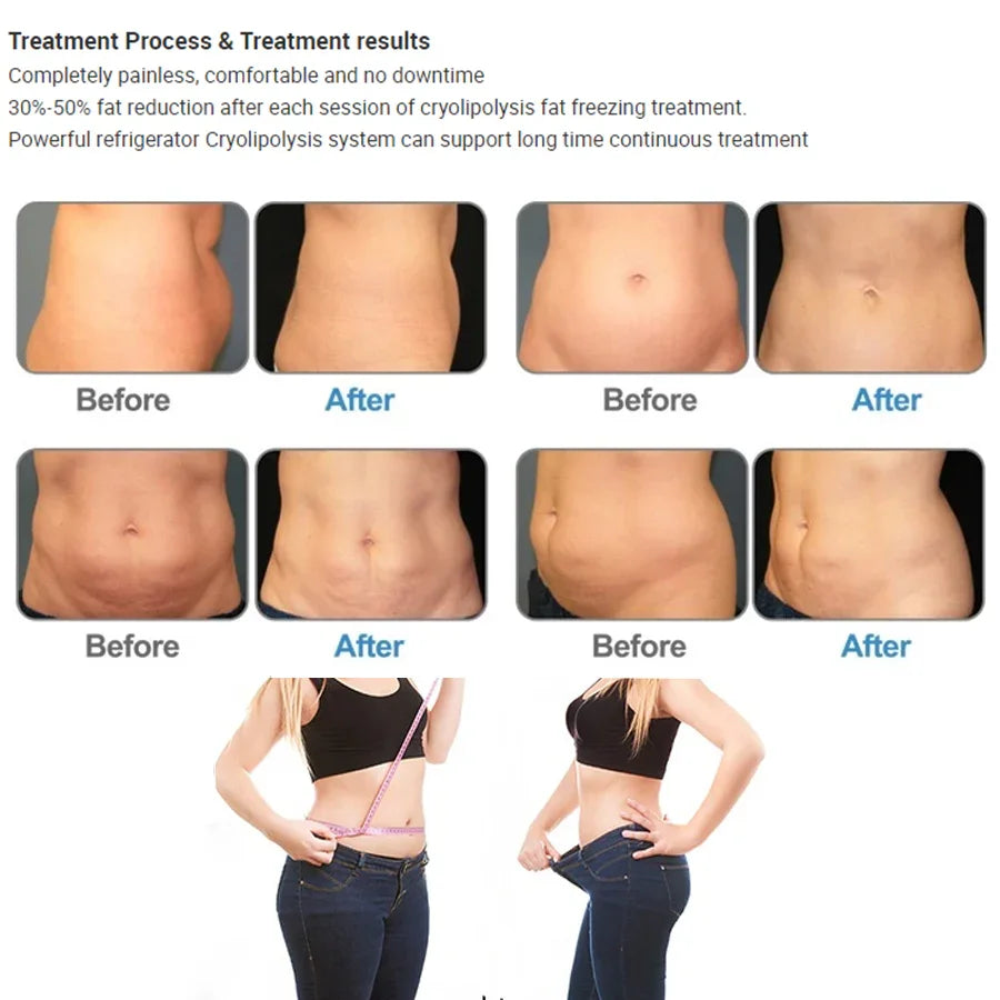 5 In 1 CryoLipolysis Fat Freezing Vaccum Cavitation RF Body Sculpting Machine Double Chin Removal