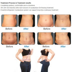 5 In 1 CryoLipolysis Fat Freezing Vaccum Cavitation RF Body Sculpting Machine Double Chin Removal