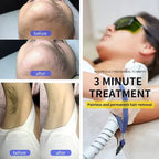 Ice Titanium Diode Laser Freezing Point Hair Removal Machine 755/808/1064nm Skin Rejuvenation Whitening