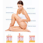 Diode Laser Hair Removal Machine Armpit Hair Removal Skin Rejuvenation Whitening 755/810/1064nm